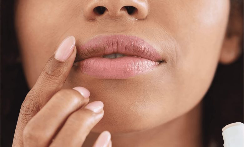 How to Prevent and Soothe Chapped Lips All Year Round